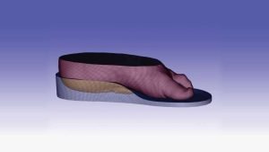 Orthotic 3D Scan Results