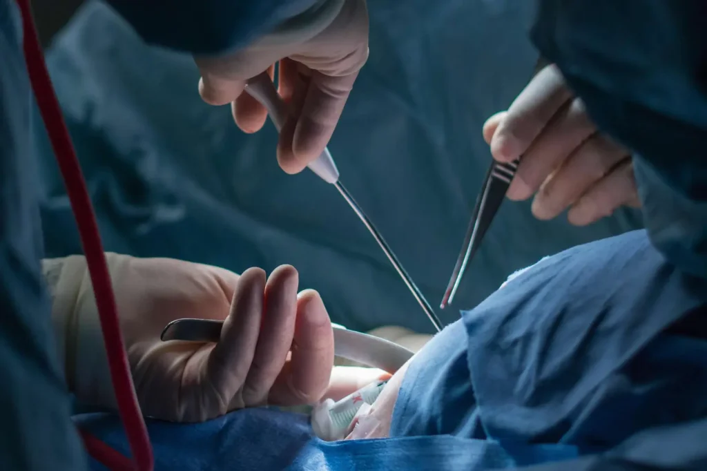 Surgical planning