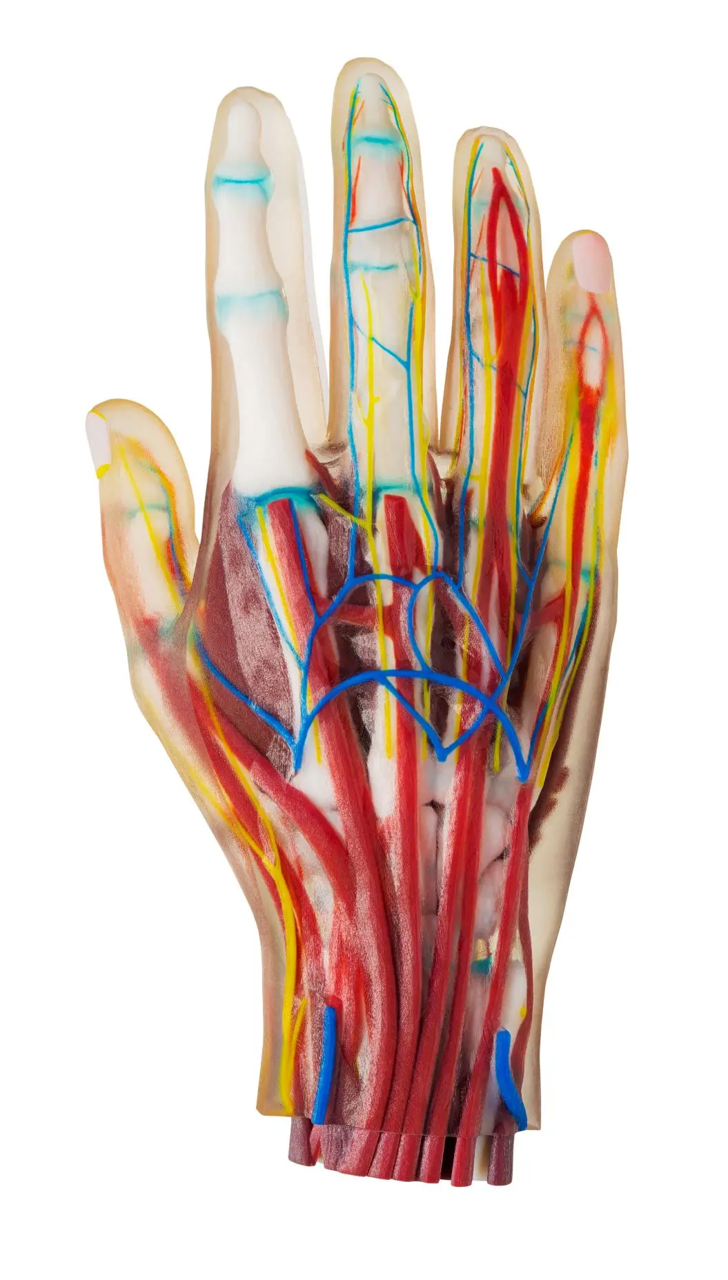 Hand RadioMatrix-PolyJet Medical Material
