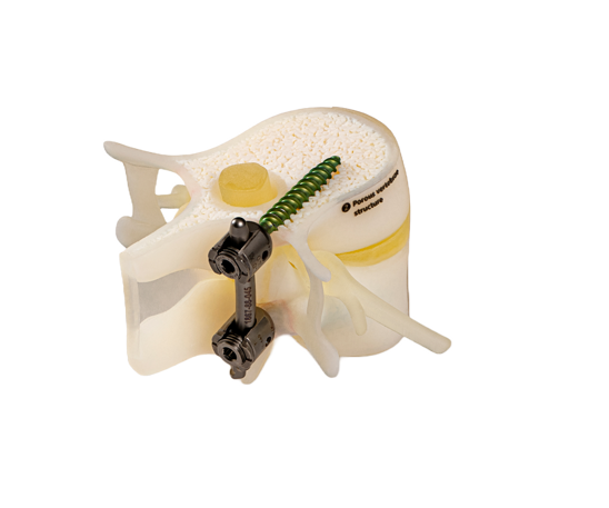 bonematrix polyjet material