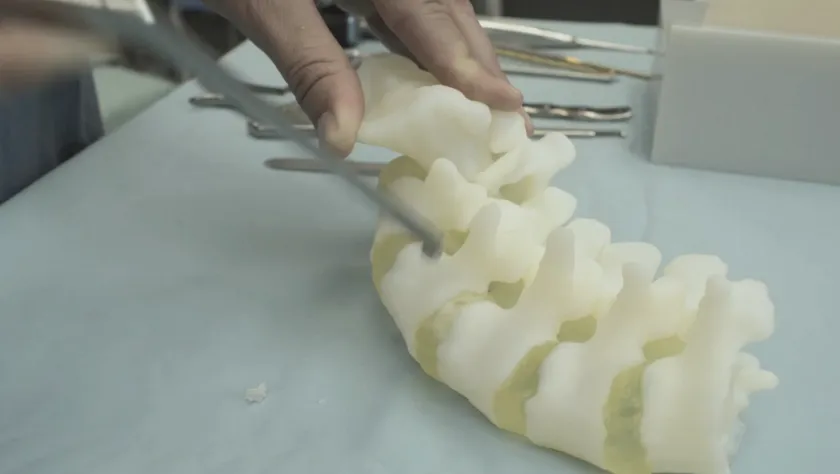 3D printed bone with Bonematrix