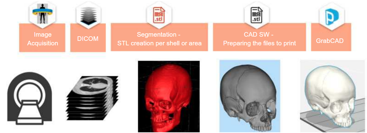 Workflow of Creating 3D Printed Anatomy Models
